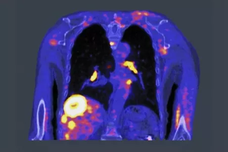 MATLAB-Cancer Treatment-2.jpg