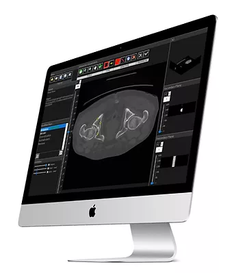 MATLAB-Cancer Treatment-3.jpg